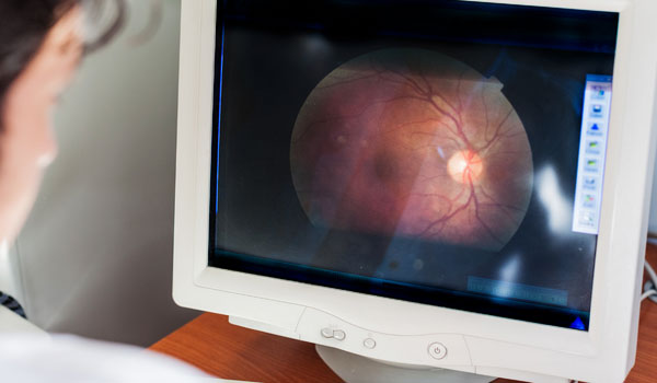 Retinal-Vein-Occlusions-conditions